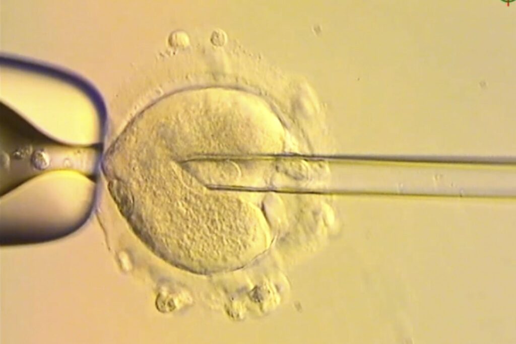 UK Babies Born Using DNA From Three People to Prevent Disease