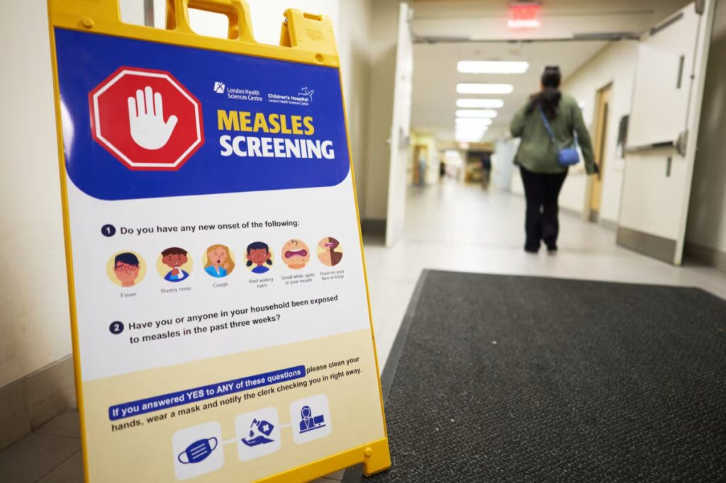 Canada risks losing measles elimination status as U.S. outbreaks grow