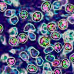 Measles Cases Quadruple Annual U.S. Average in Weeks-thumbnail