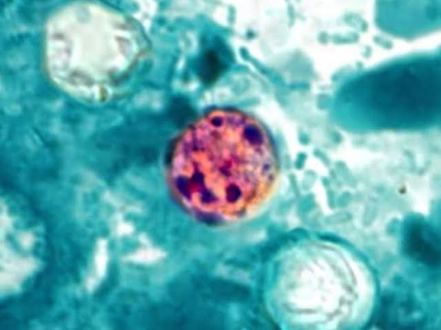 Cyclospora Outbreak Reaches 1,000 Cases in Michigan, Source Unknown-thumbnail